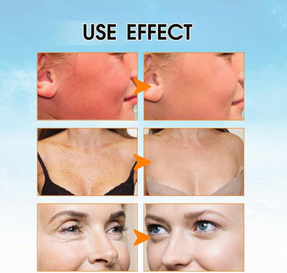 NEWLIEERS Sunscreen - SPF 50+ PA++++ Anthelios UVMune 400 SPF 50+ Hydrating Sunscreen (50ml) (50 ml)