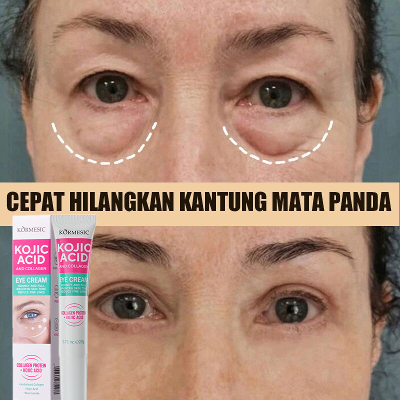 KORMESIC Coric Acid &amp; Collagen Eye Cream 20g – Brightening &amp; Anti-Aging Eye Car