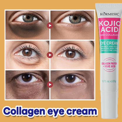 KORMESIC Coric Acid &amp; Collagen Eye Cream 20g – Brightening &amp; Anti-Aging Eye Car